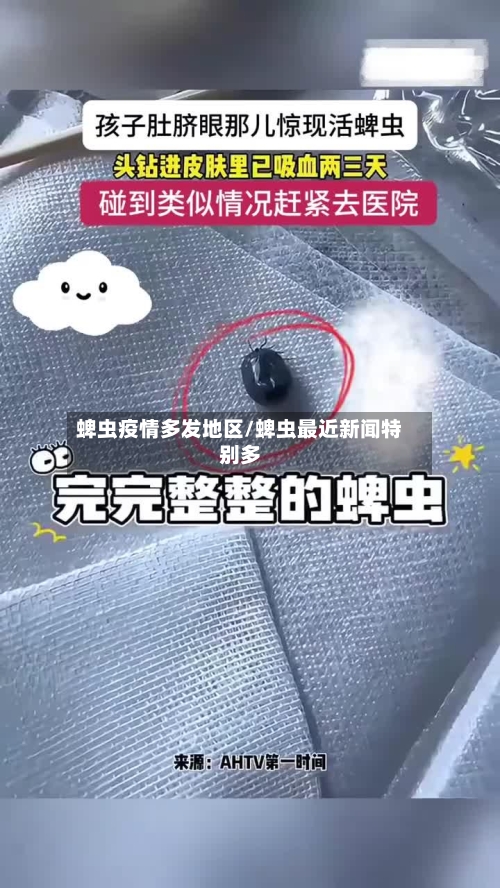 蜱虫疫情多发地区/蜱虫最近新闻特别多